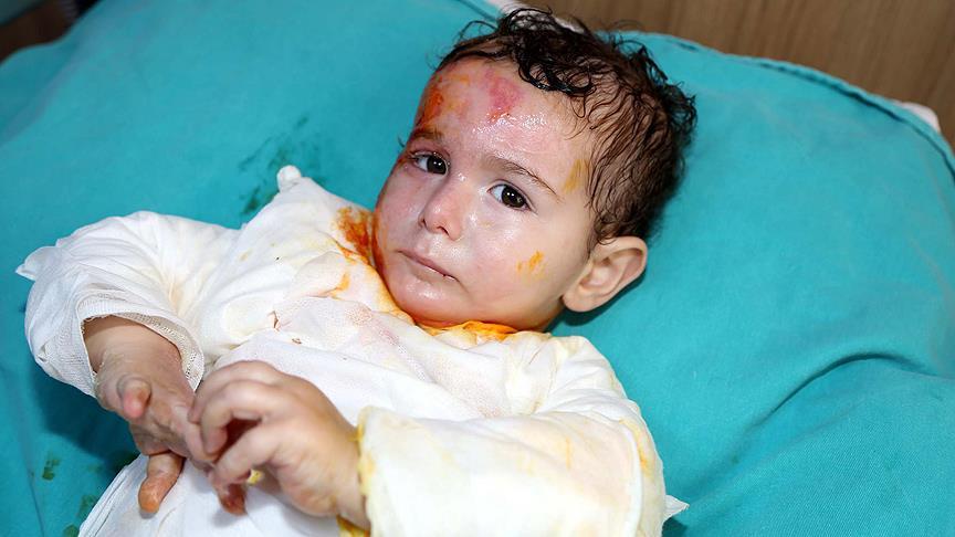 Suriyeli bebeğin yaşam savaşı