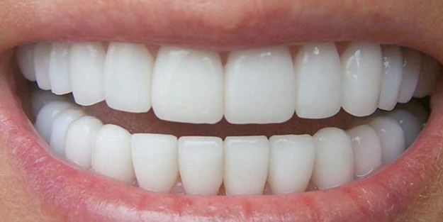 Kilo veremiyorsanız sebebi dişleriniz olabilir