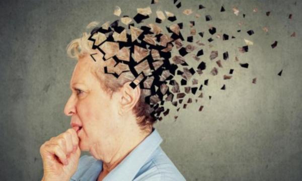 Alzheimer ölümlerinde şaşırtan artış