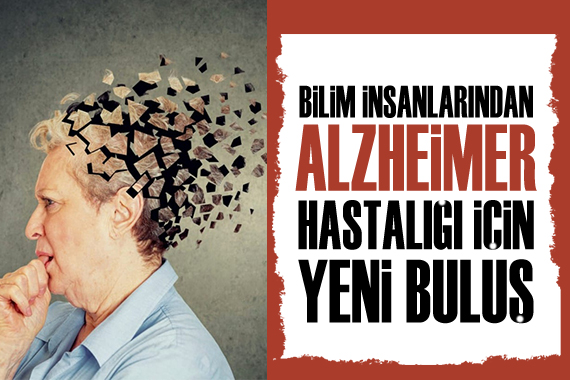 Alzheimer hastalığının teşhisi için yeni buluş