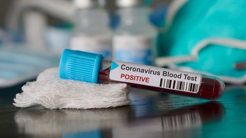 Koronavirüs ten koruyan 3 ilaç