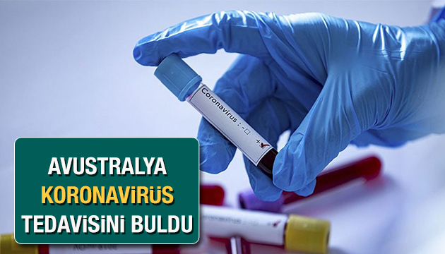 Avustralya koronavirüs tedavisinde olumlu sonuç aldı