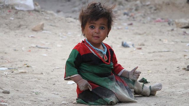 Afganistan da 600 bin çocuğun hayatı gelecek üç haftaya bağlı