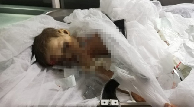 9 aylık Muhammed bebek YPG/PKK nın kurbanı oldu