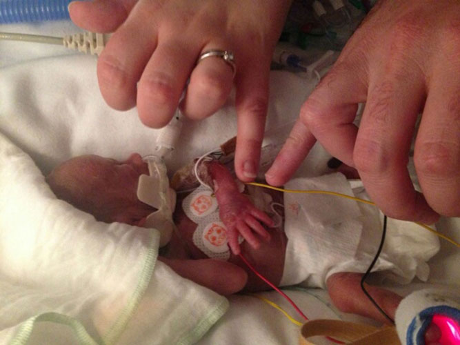 Bir günlük bebeğin kalbi 100 dakika durduruldu