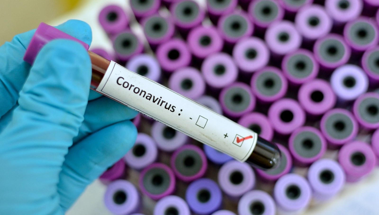 Koronavirüsünde son dakika gelişmesi