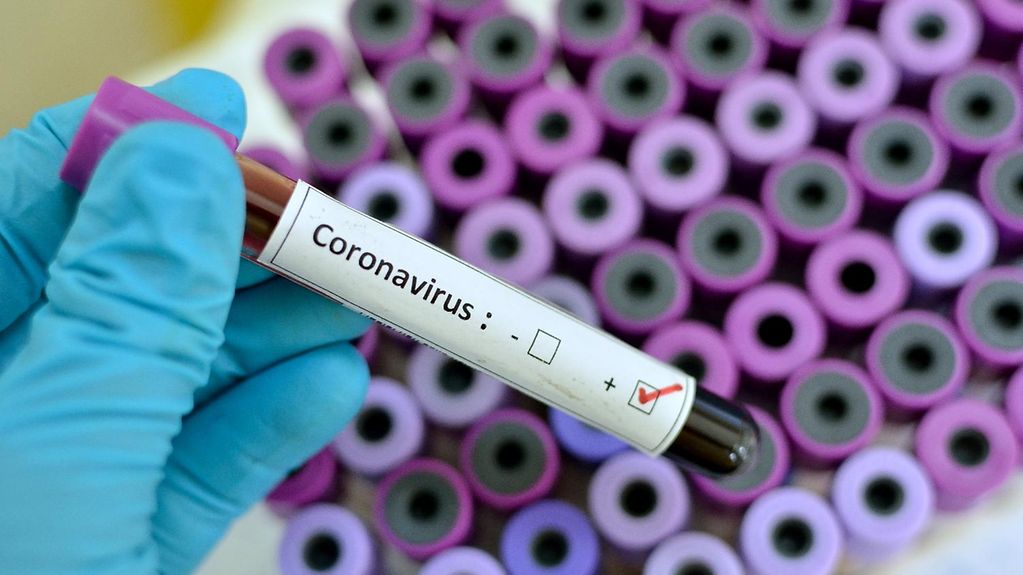 Fransa da koronavirüs nedeniyle ölenlerin sayısı 28 bin 239 a çıktı