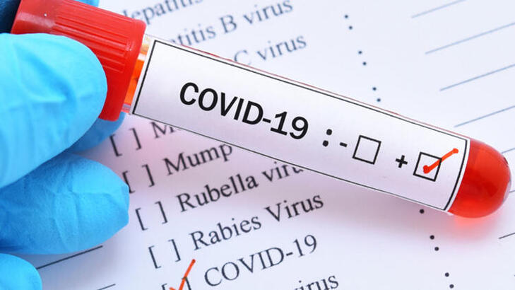 ABD de koronavirüs nedeniyle ölenlerin sayısı 10 bini geçti