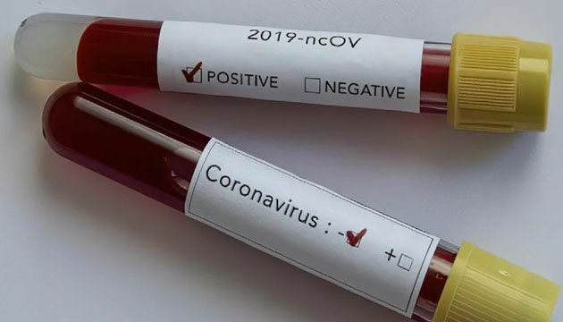 Koronavirüste can kaybı 3 bin 258 e yükseldi