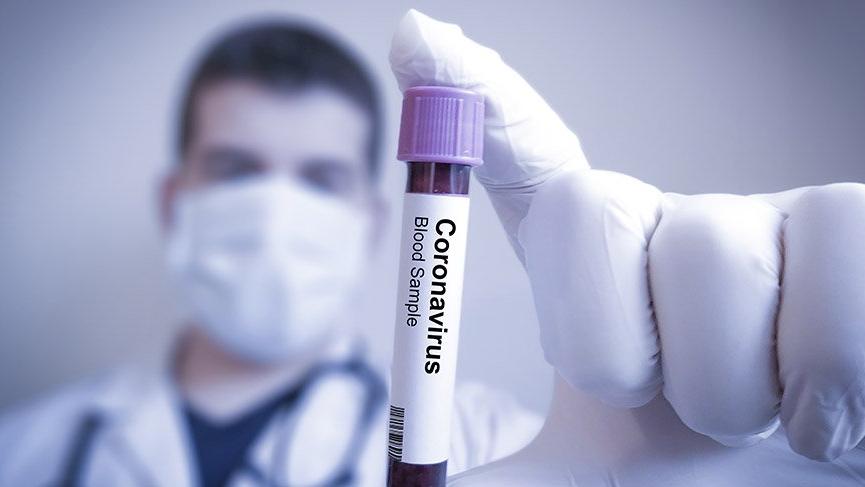 Dicle Üniversitesi nden  koronavirüsten ölüm  iddiası hakkında açıklama