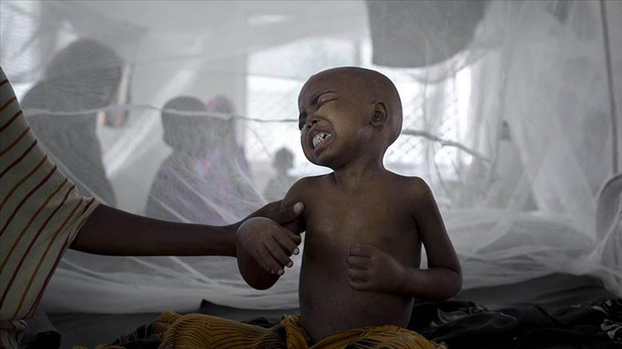 Nijerya da  teşhis konulamayan hastalık : 3 çocuk öldü