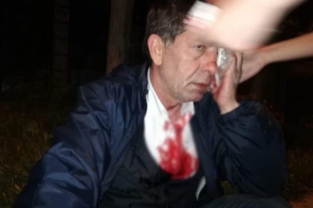 Gazeteci Demirağ dan saldırı sonrası ilk açıklama