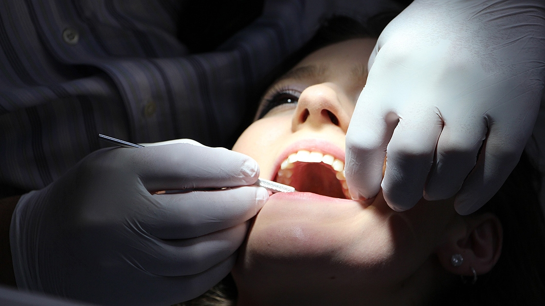 Ne kadar zamanda bir diş kontrolü yapılmalı?