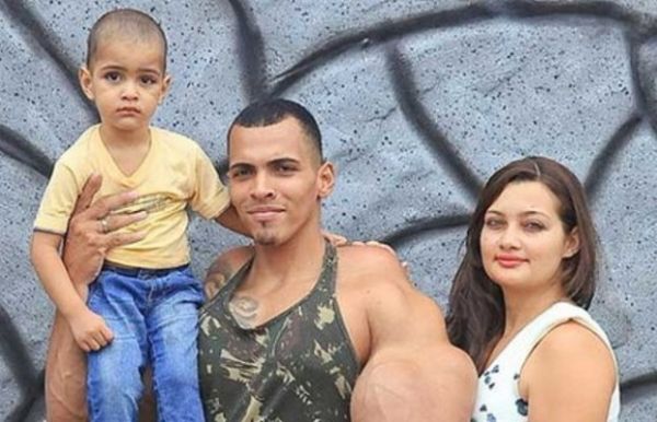İŞTE DÜNYANIN EN KORKUNÇ VÜCUT GELİŞTİRME VAKASI!  - 2. fotoğraf