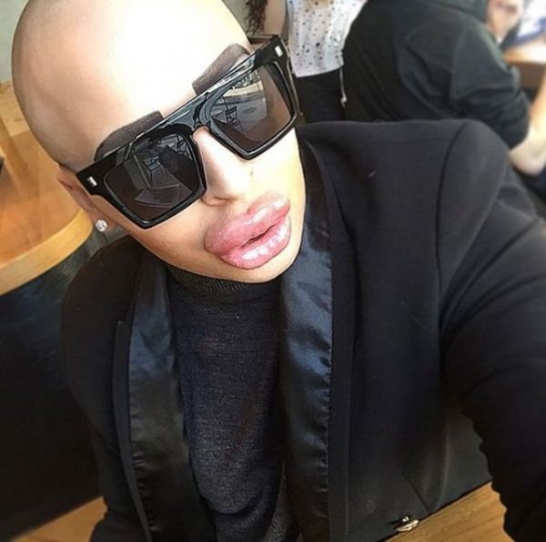 Kim Kardashian'a benzemek için servet harcadı! - 4. fotoğraf