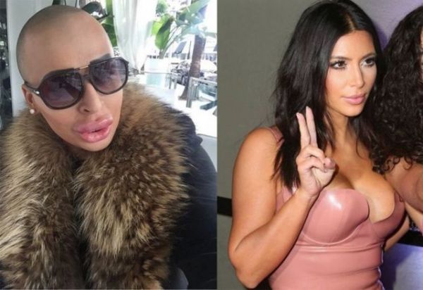 Kim Kardashian'a benzemek için servet harcadı! - 1. fotoğraf