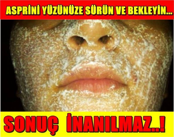 SONUÇ İNANILMAZ! ASPRİNİ YÜZÜNÜZE SÜRÜN VE BEKLEYİN... - 2. fotoğraf