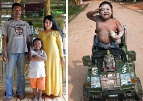 Bu çocuk günde 40 sigara içiyordu! Sigarayı bıraktı ama şimdiki hali... - 6. fotoğraf