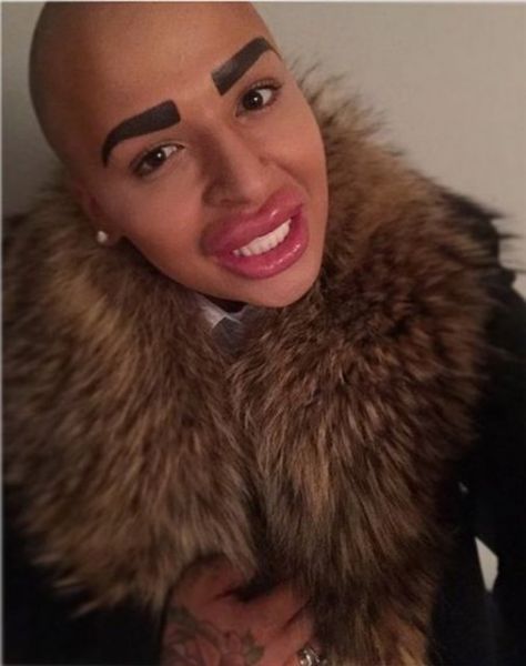 Kim Kardashian'a benzemek için servet harcadı! - 10. fotoğraf