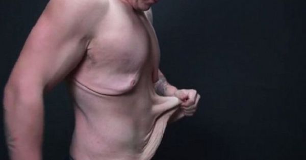 Sevgilisini Kazanmak İçin 163 Kilodan 90 Kiloya Düştü... - 4. fotoğraf