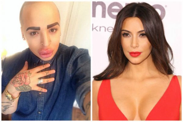 Kim Kardashian'a benzemek için servet harcadı! - 2. fotoğraf