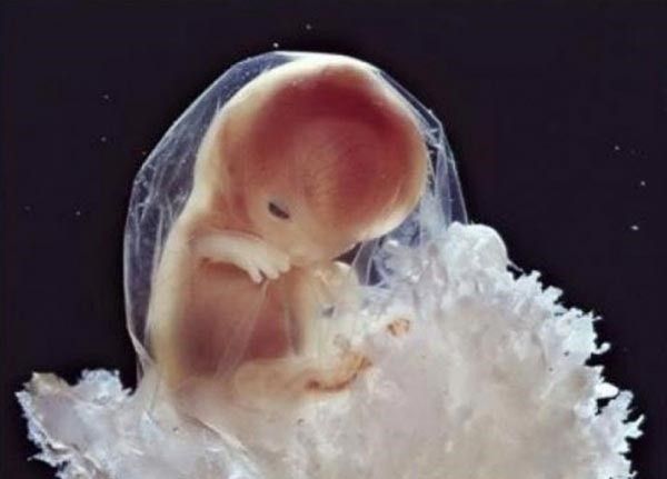 CANIM YANIYOR ANNEE! MUTLAKA OKUYUN, GÖZ YAŞLARINIZI TUTAMAYACAKSINIZ... - 3. fotoğraf
