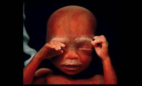 CANIM YANIYOR ANNEE! MUTLAKA OKUYUN, GÖZ YAŞLARINIZI TUTAMAYACAKSINIZ... - 8. fotoğraf