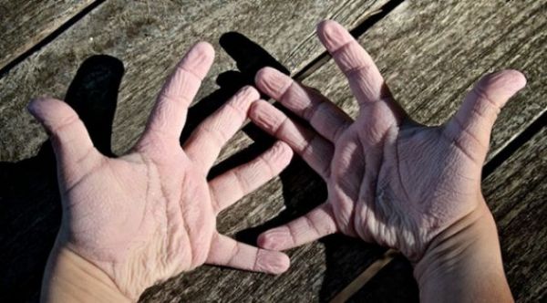 EĞER ELLERİNİZ BÖYLE OLUYORSA... ASLINDA BU BİR YETENEK! - 6. fotoğraf