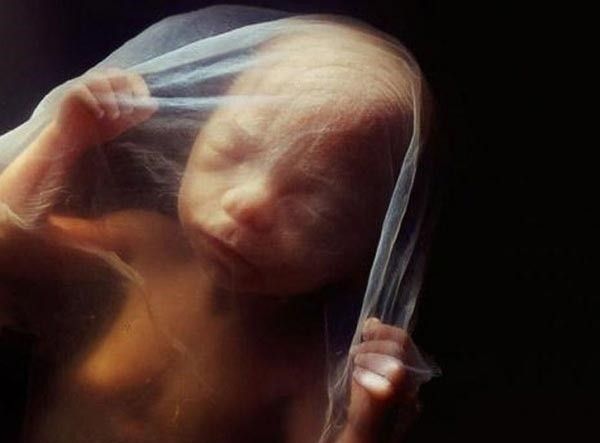 CANIM YANIYOR ANNEE! MUTLAKA OKUYUN, GÖZ YAŞLARINIZI TUTAMAYACAKSINIZ... - 9. fotoğraf