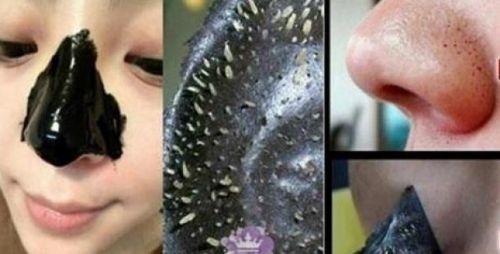 SİYAH NOKTALARDAN EVDE HAZIRLAYIP 20 DAKİKA İÇERİSİNDE KURTULACAKSINIZ!  - 2. fotoğraf