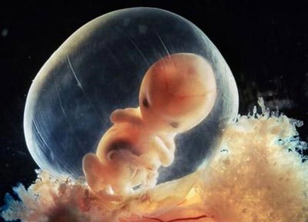 CANIM YANIYOR ANNEE! MUTLAKA OKUYUN, GÖZ YAŞLARINIZI TUTAMAYACAKSINIZ... - 2. fotoğraf