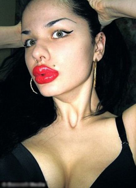 Estetik faciaları! - 1. fotoğraf