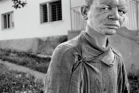 Akıl hastanelerinden kan donduran fotoğraflar - 14. fotoğraf