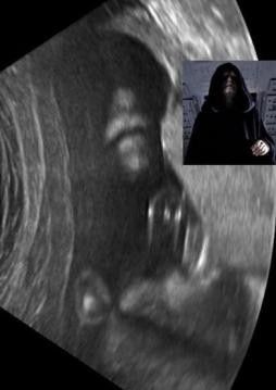 TEK İSTEKLERİ BEBEĞİN CİNSİYETİNİ ÖĞRENMEKTİ AMA... ULTRASONU GÖRÜNCE BAYILDILAR! - 4. fotoğraf