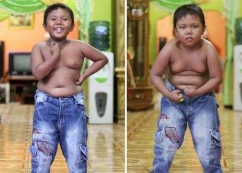 Bu çocuk günde 40 sigara içiyordu! Sigarayı bıraktı ama şimdiki hali... - 8. fotoğraf