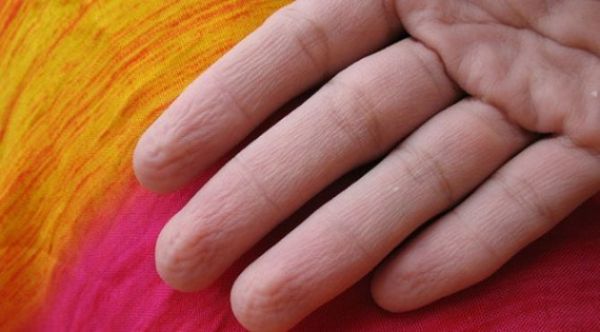 EĞER ELLERİNİZ BÖYLE OLUYORSA... ASLINDA BU BİR YETENEK! - 7. fotoğraf