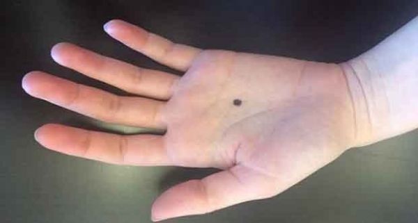 AVUÇ İÇİNE SİYAH NOKTA NE ANLAMA GELİYOR!  ÖĞRENİNCE AĞZINIZ AÇIK KALACAK! - 9. fotoğraf