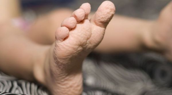 EĞER ELLERİNİZ BÖYLE OLUYORSA... ASLINDA BU BİR YETENEK! - 3. fotoğraf