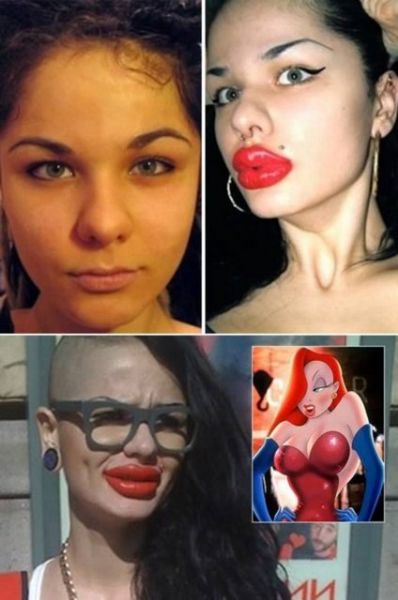 Estetik faciaları! - 5. fotoğraf