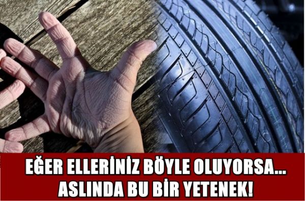 EĞER ELLERİNİZ BÖYLE OLUYORSA... ASLINDA BU BİR YETENEK! - 1. fotoğraf