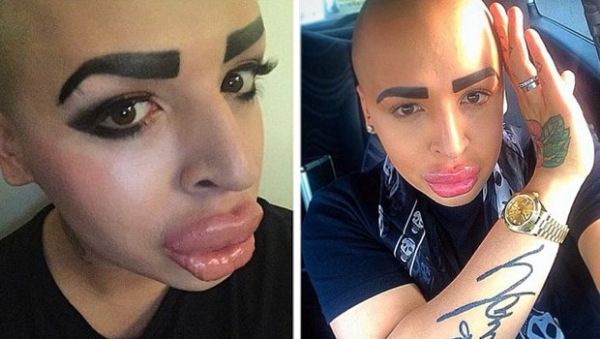 Kim Kardashian'a benzemek için servet harcadı! - 16. fotoğraf