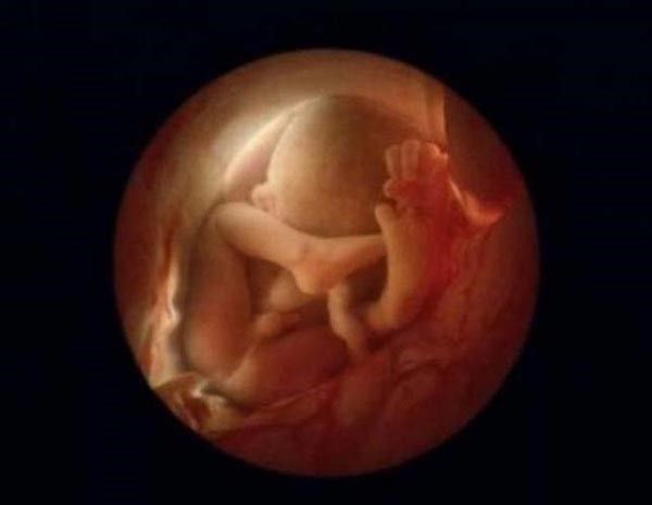 CANIM YANIYOR ANNEE! MUTLAKA OKUYUN, GÖZ YAŞLARINIZI TUTAMAYACAKSINIZ... - 11. fotoğraf