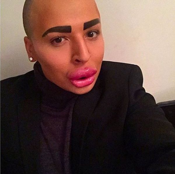 Kim Kardashian'a benzemek için servet harcadı! - 11. fotoğraf