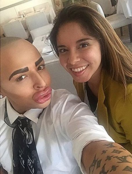 Kim Kardashian'a benzemek için servet harcadı! - 6. fotoğraf