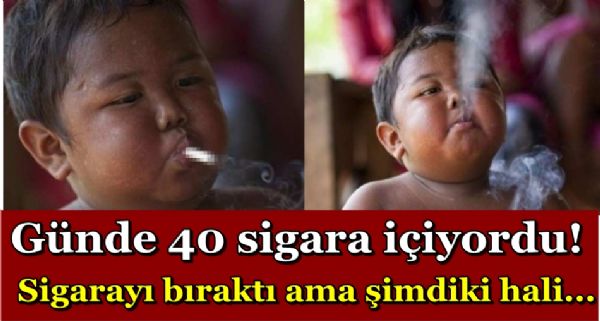 Bu çocuk günde 40 sigara içiyordu! Sigarayı bıraktı ama şimdiki hali... - 1. fotoğraf