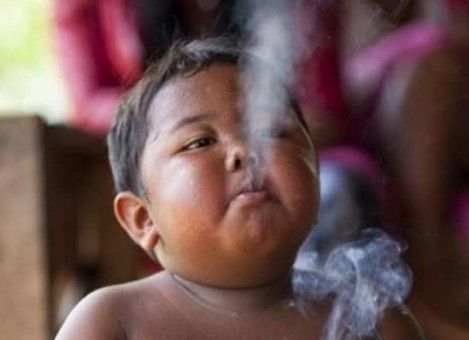 Bu çocuk günde 40 sigara içiyordu! Sigarayı bıraktı ama şimdiki hali... - 5. fotoğraf