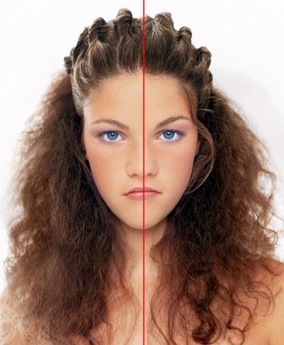 Yüzünüzde Gizli Olan 8 Hastalık Belirtisine Dikkat!!! - 5. fotoğraf