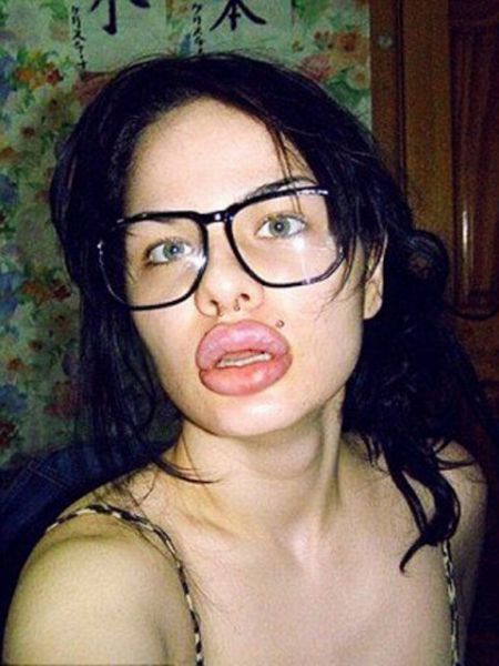 Estetik faciaları! - 3. fotoğraf