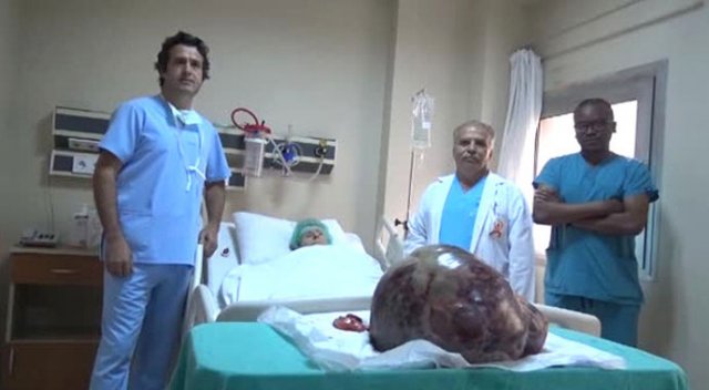 Yaşlı kadının karnından 10 kiloluk kitle çıktı!