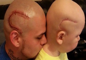 Oğlunun yara izini dövme yaptırdı!